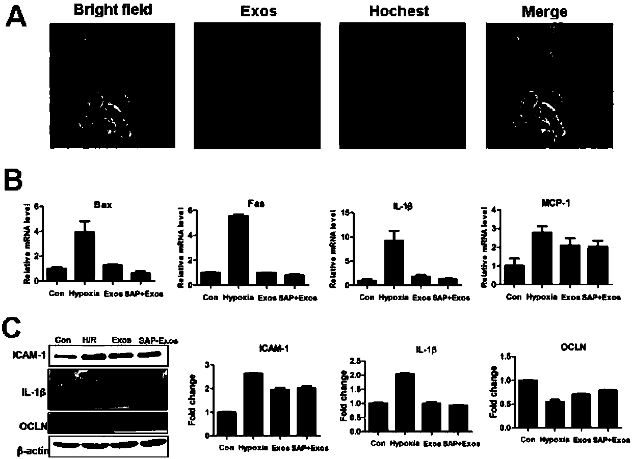 Polypeptide hydrogel with slow-release exosomes and preparation method and application thereof