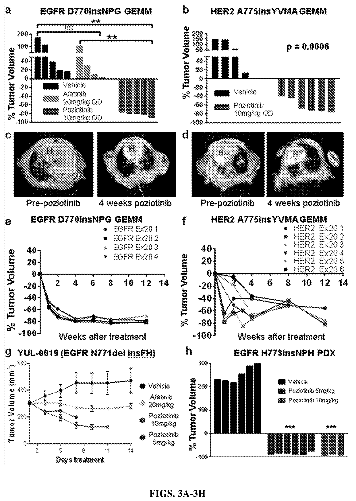 Compounds with Anti-tumor activity against cancer cells bearing EGFR or her2 exon 20 mutations