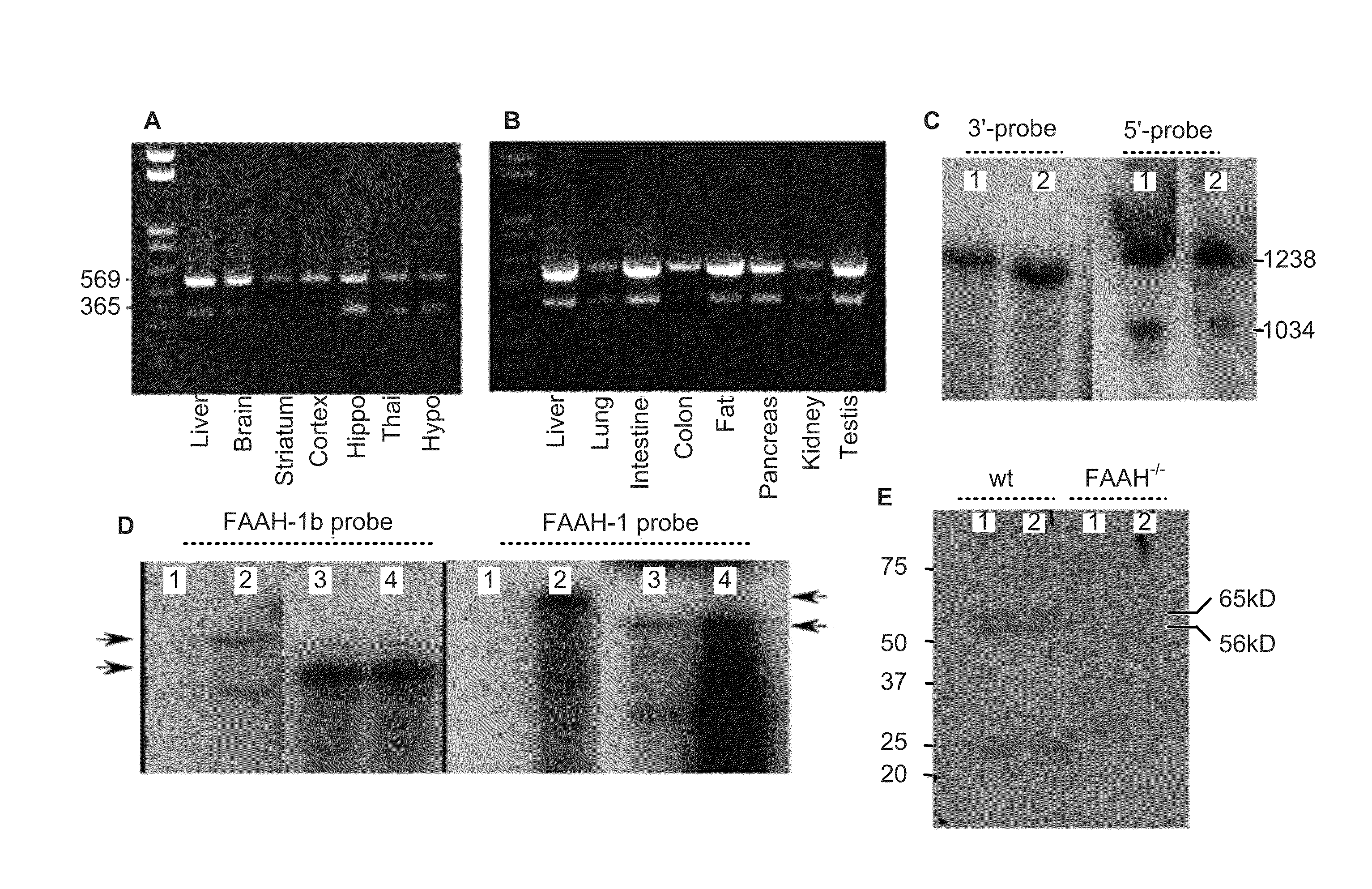 Inhibitors of anandamide transport and their therapeutic uses