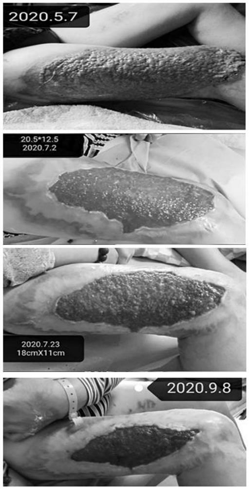 Traditional Chinese medicine composition for promoting wound healing and preparation method thereof