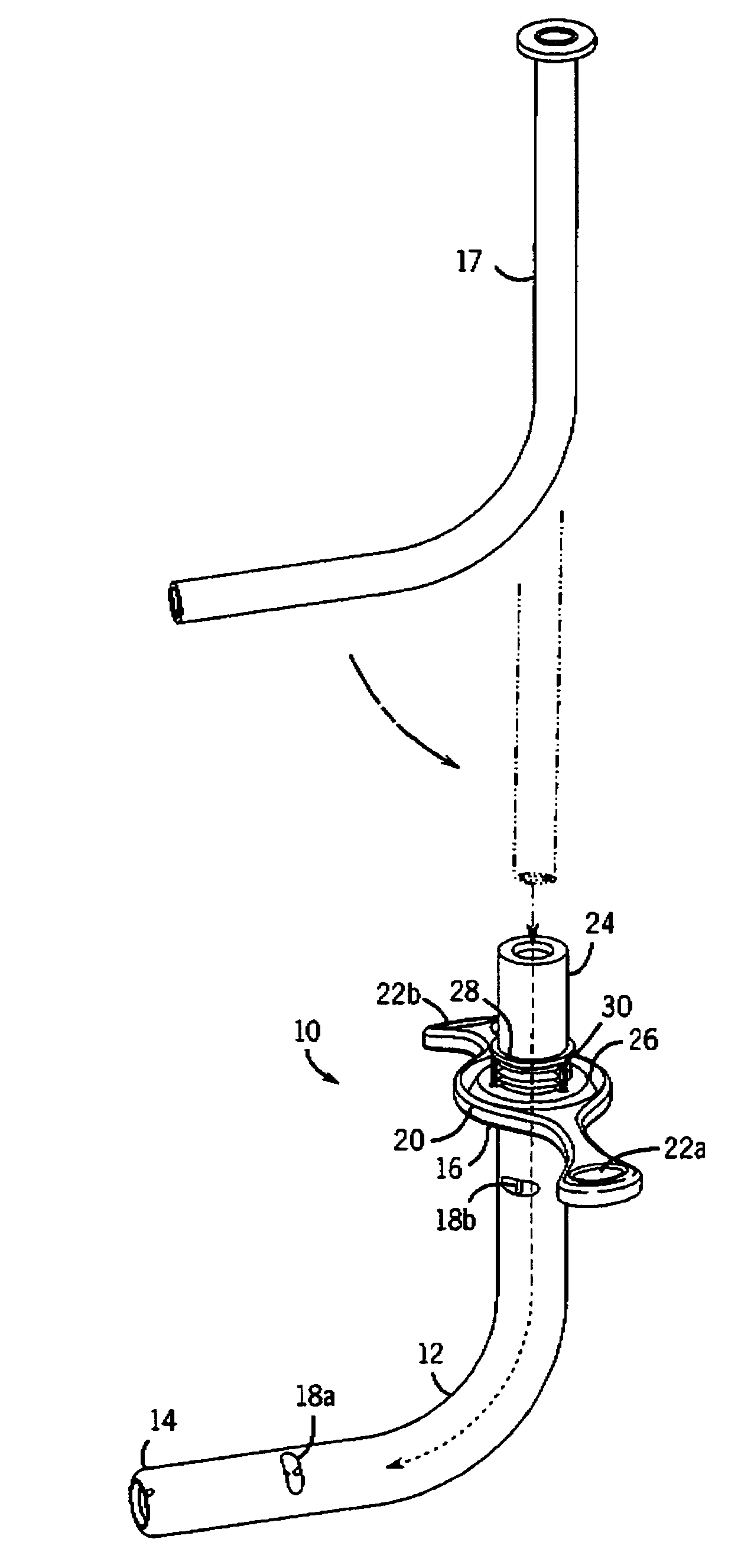 Tracheostomy tube and technique for using the same