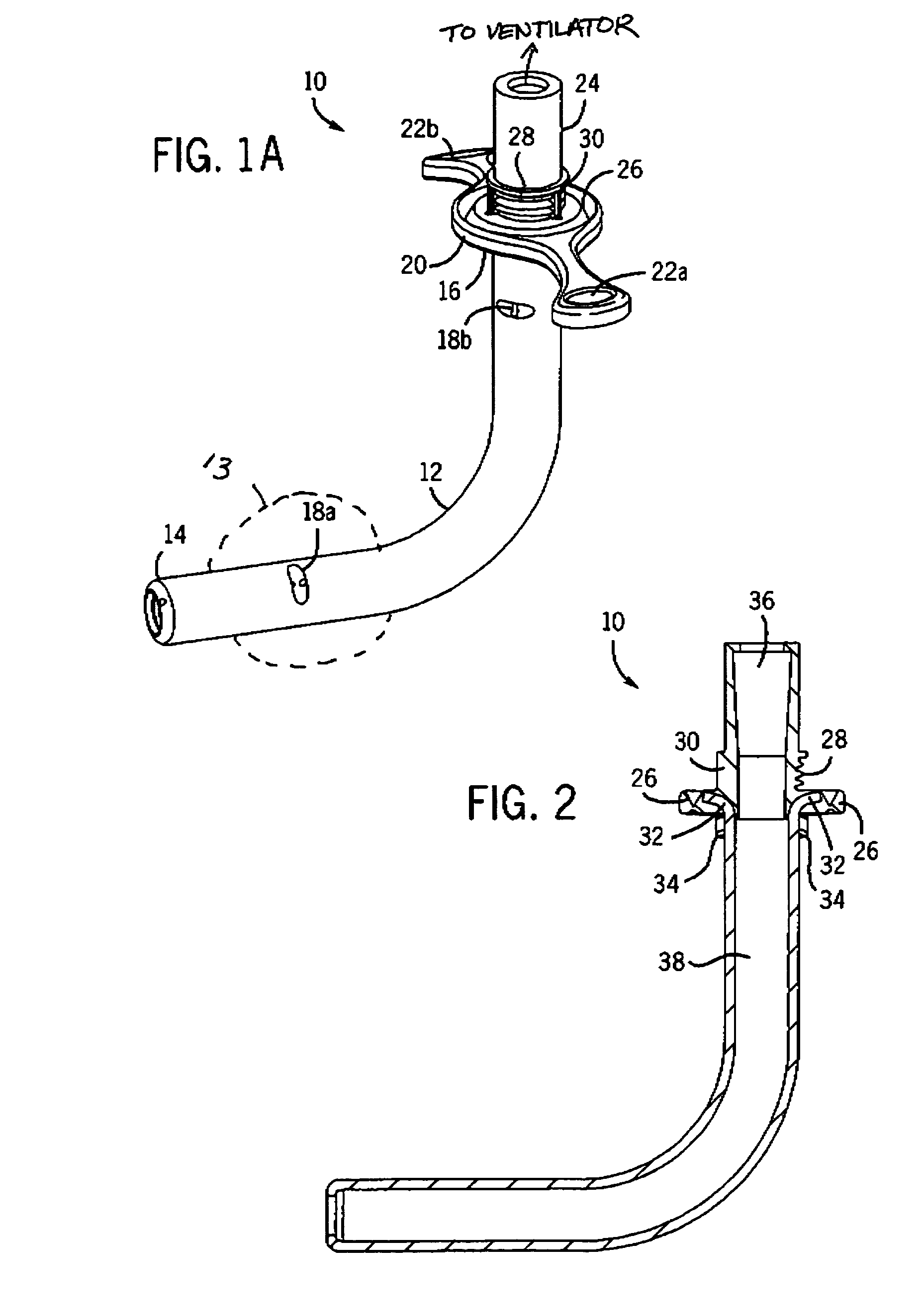 Tracheostomy tube and technique for using the same