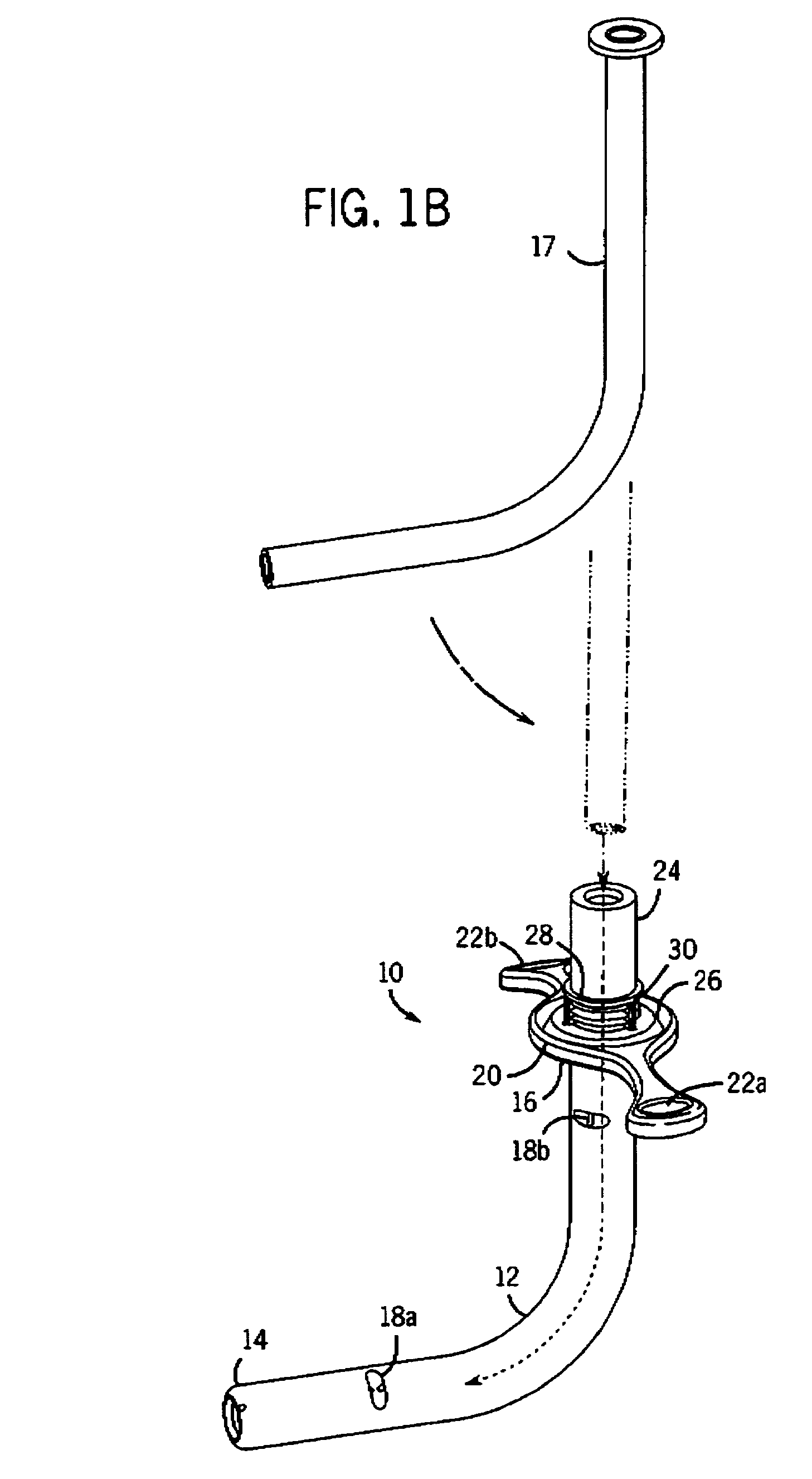 Tracheostomy tube and technique for using the same