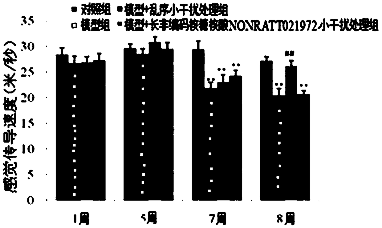 Application of long noncoding ribonucleic acid nonratt021972 small interfering ribonucleic acid in the preparation of drugs for diabetes complicated with neuropathic pain