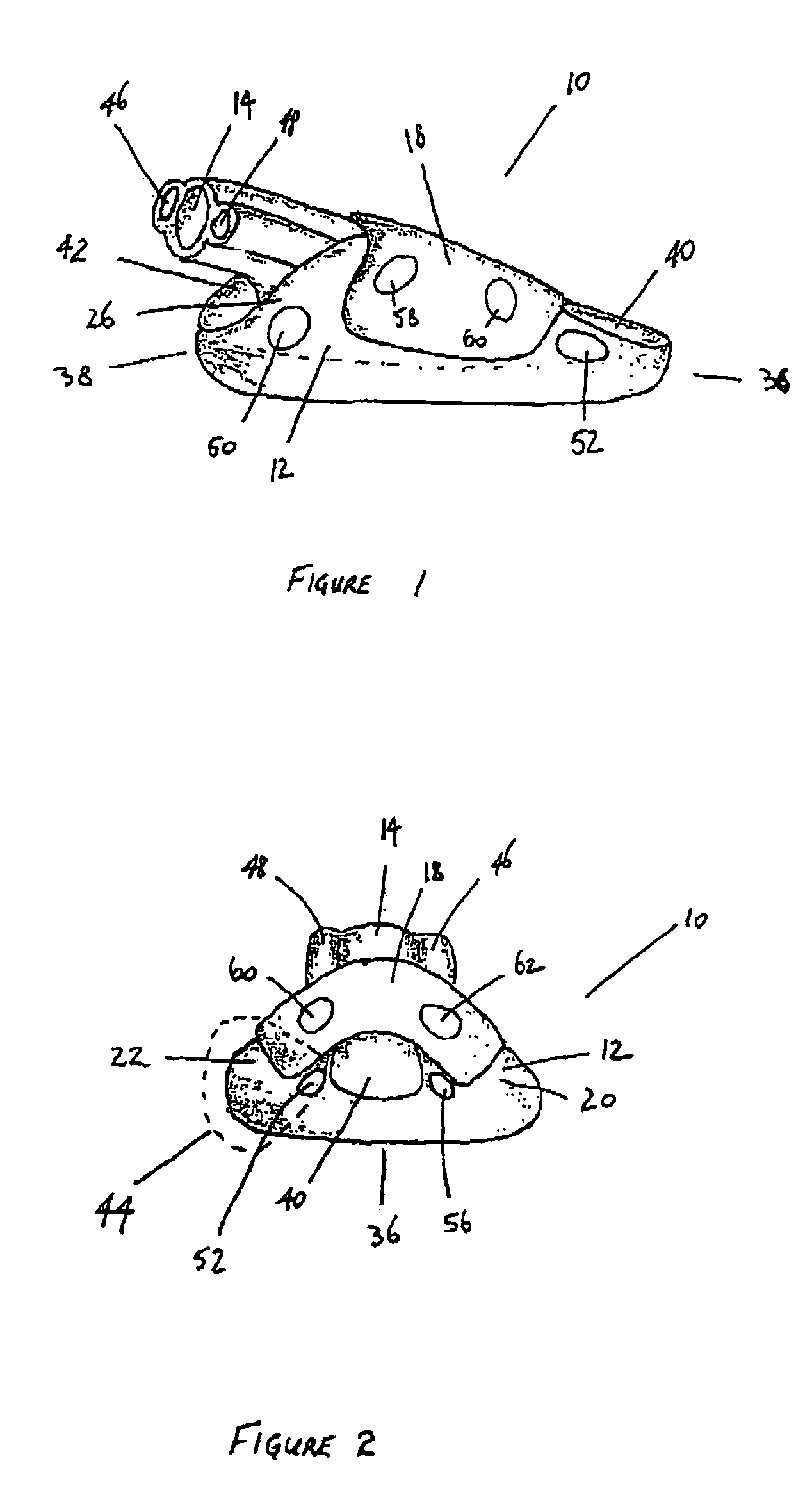 Laryngeal mask