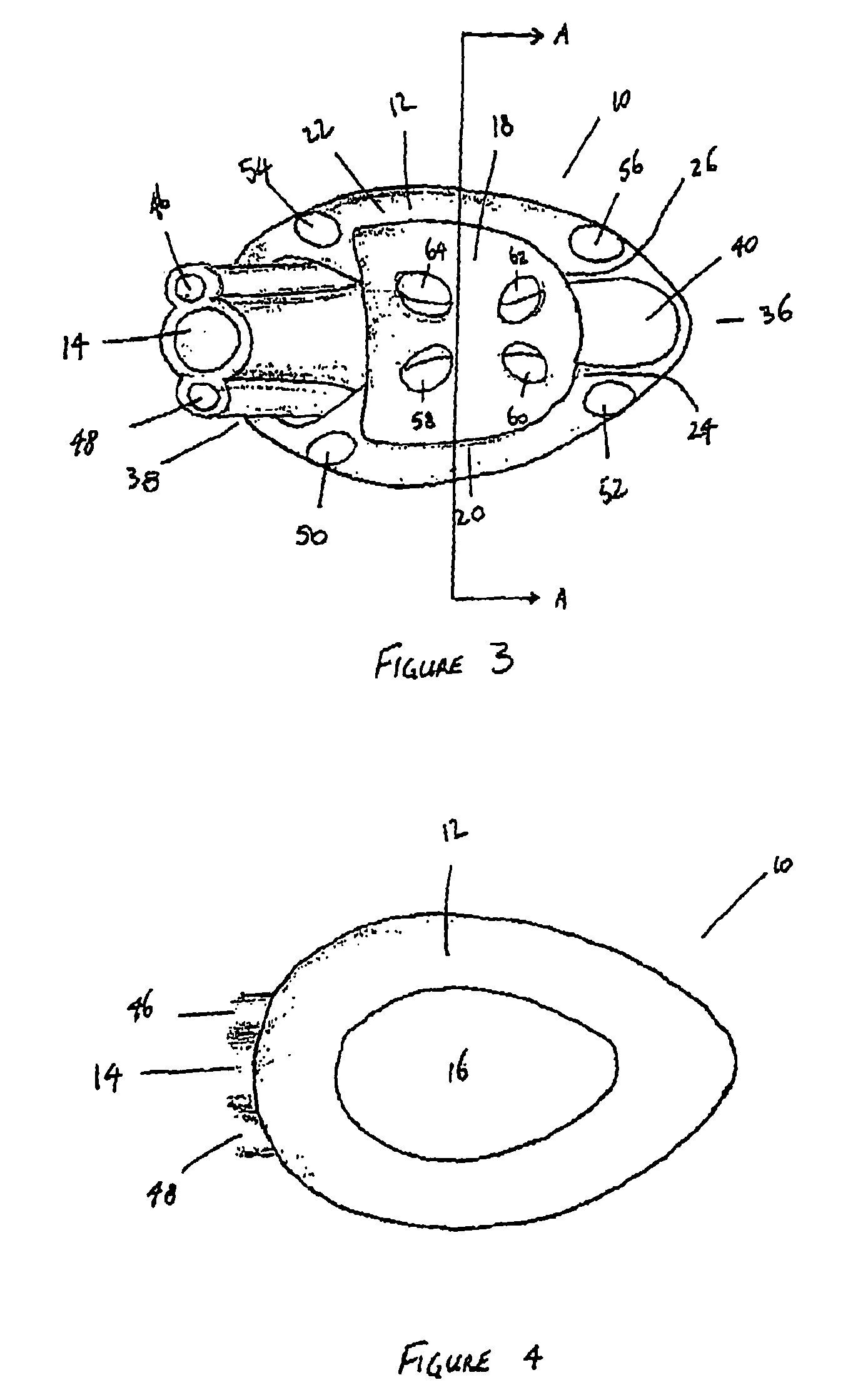 Laryngeal mask