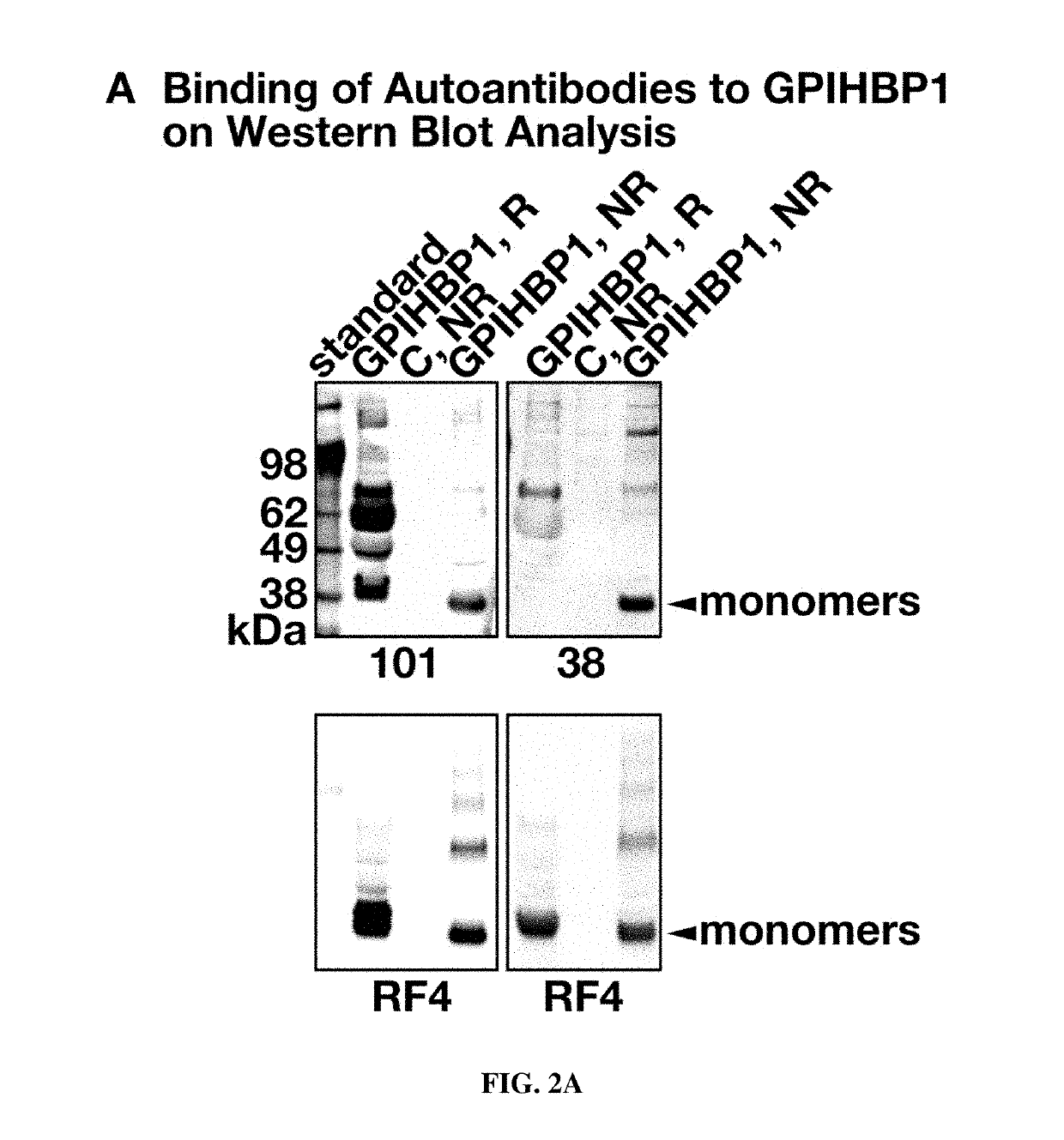 Methods and compositions for treating hypertriglyceridemia