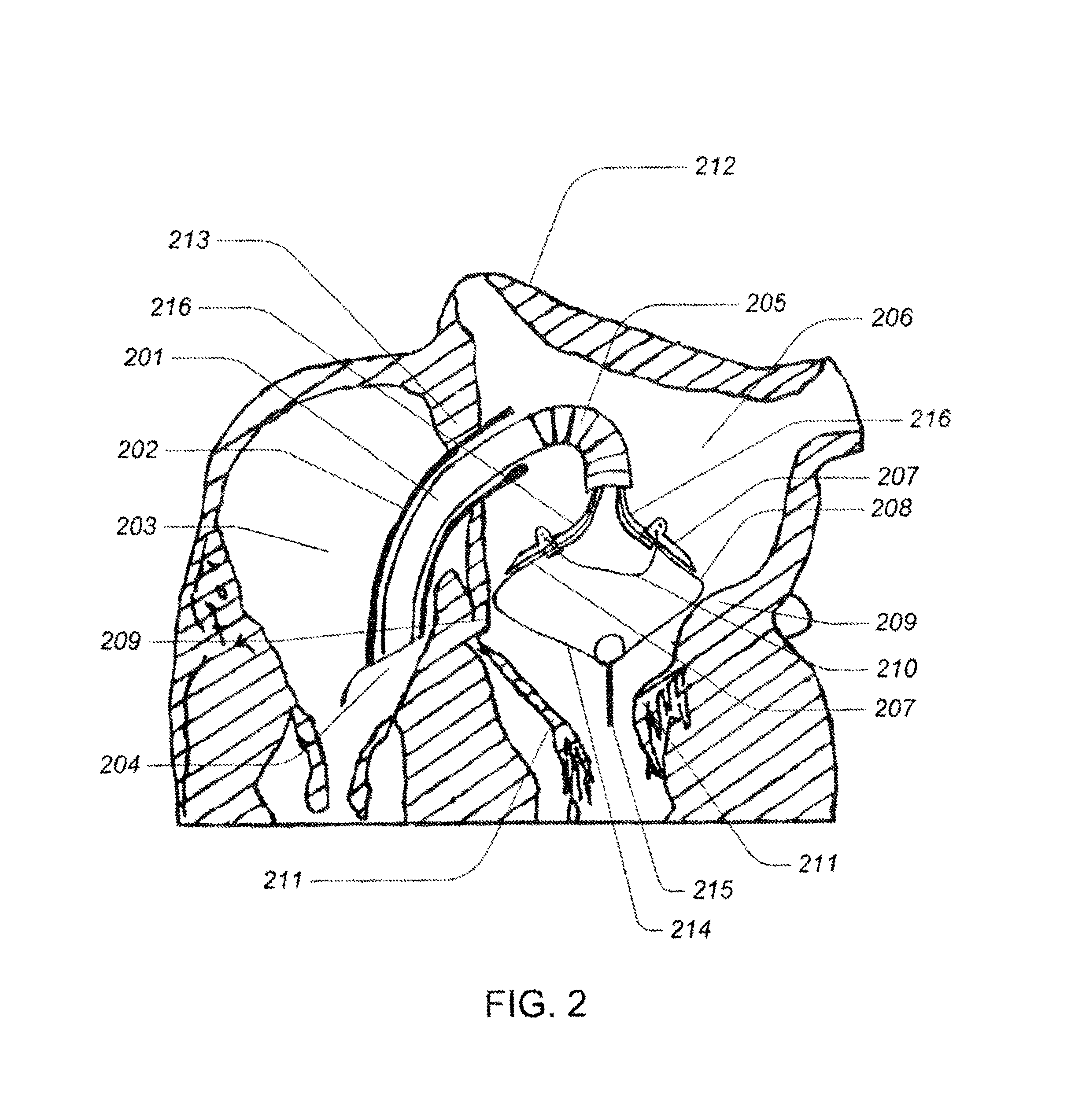 Tissue anchor system