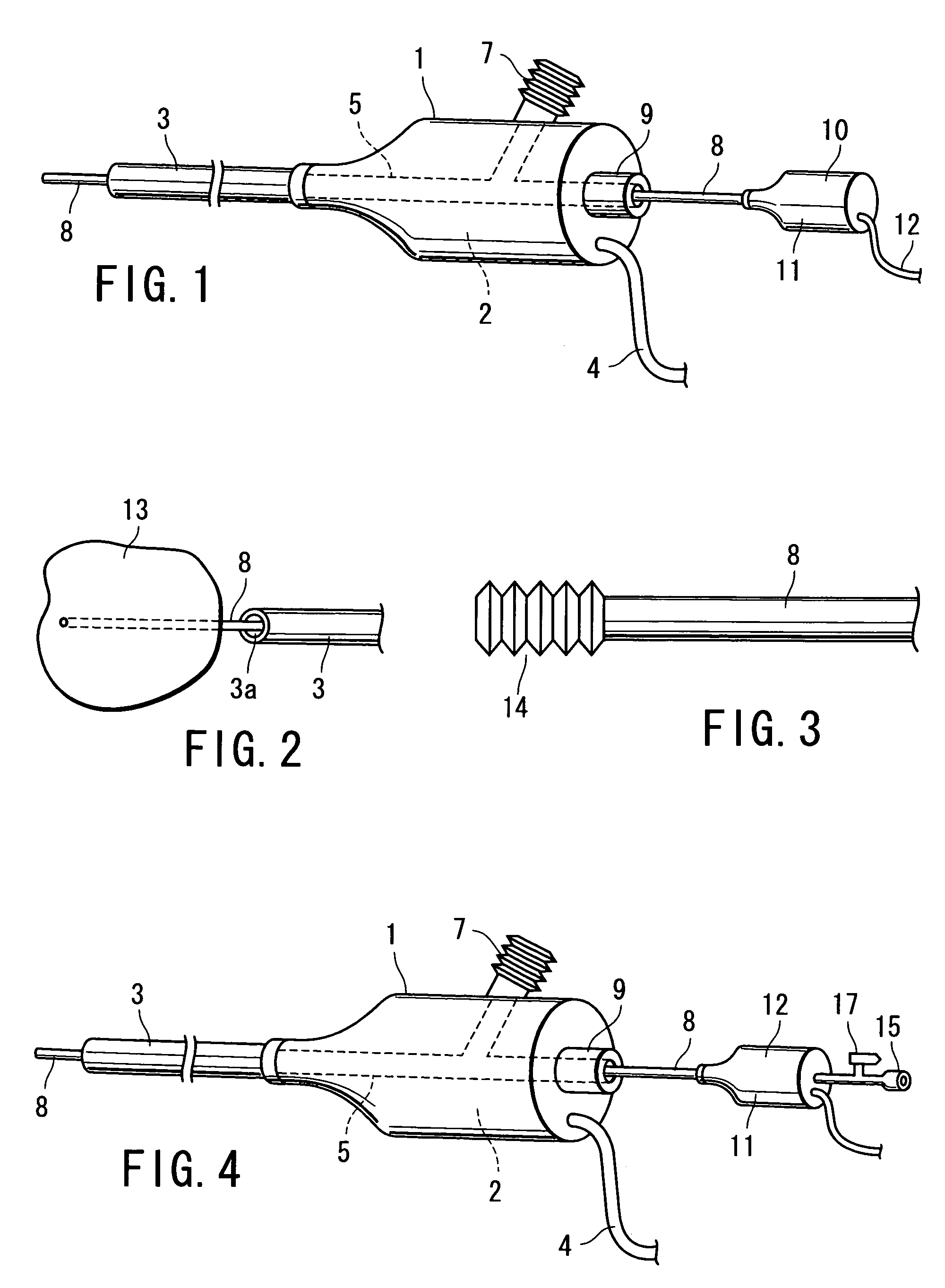 Calculus manipulation apparatus