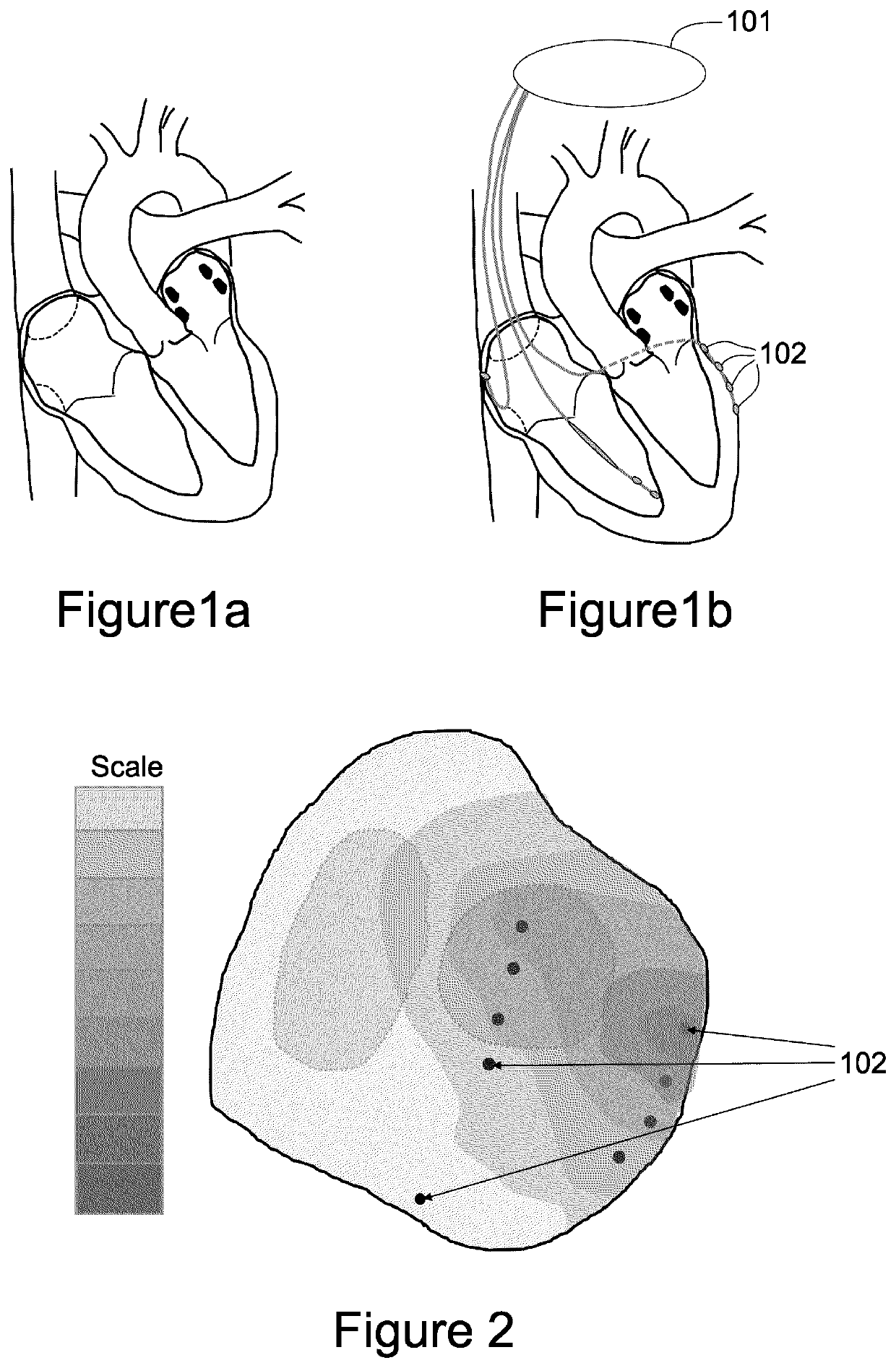 Measuring time to fusion as a means of determining degree of parallel activation of the heart