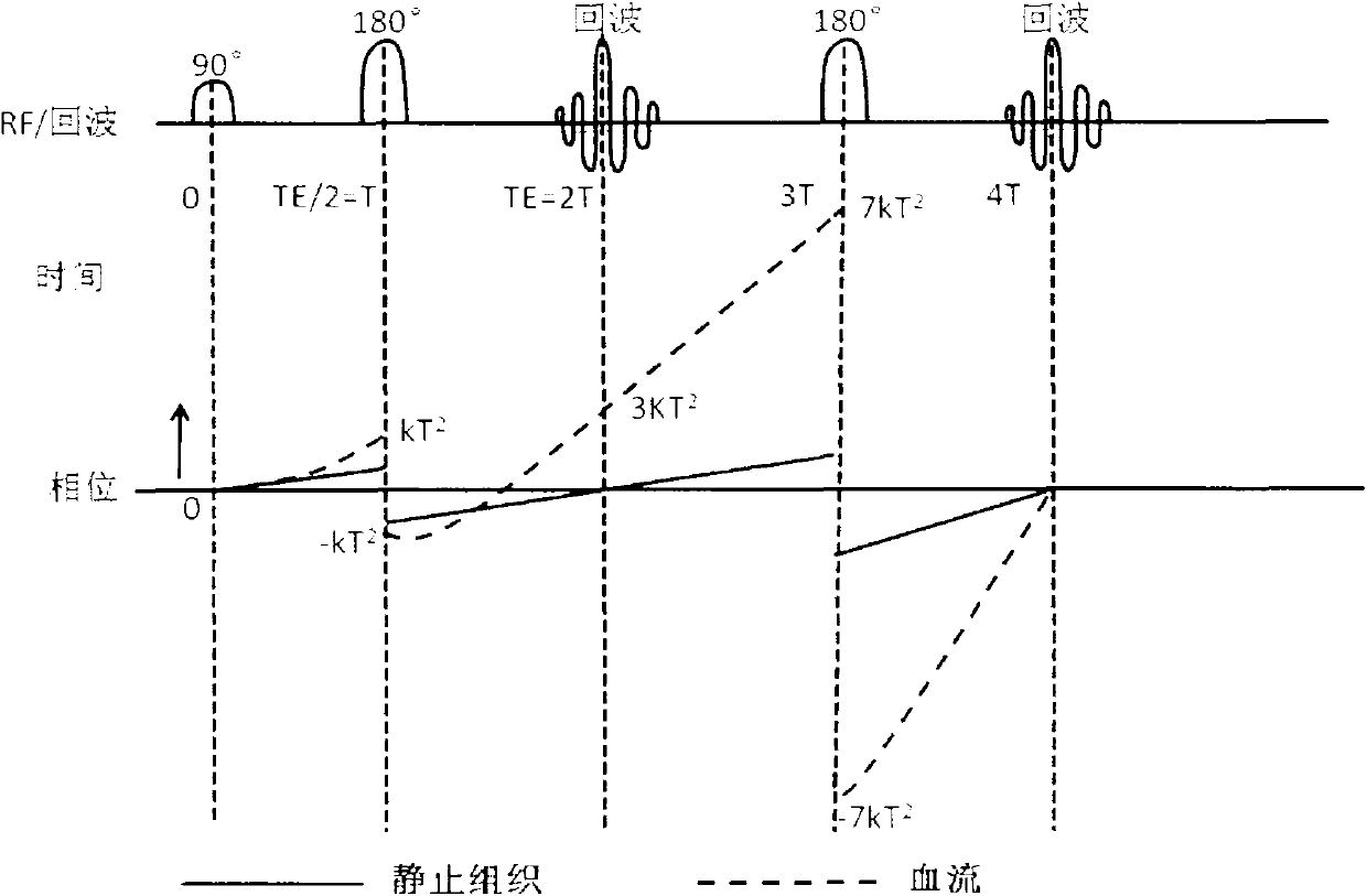 A Flow Compensation Method for Magnetic Resonance Imaging System