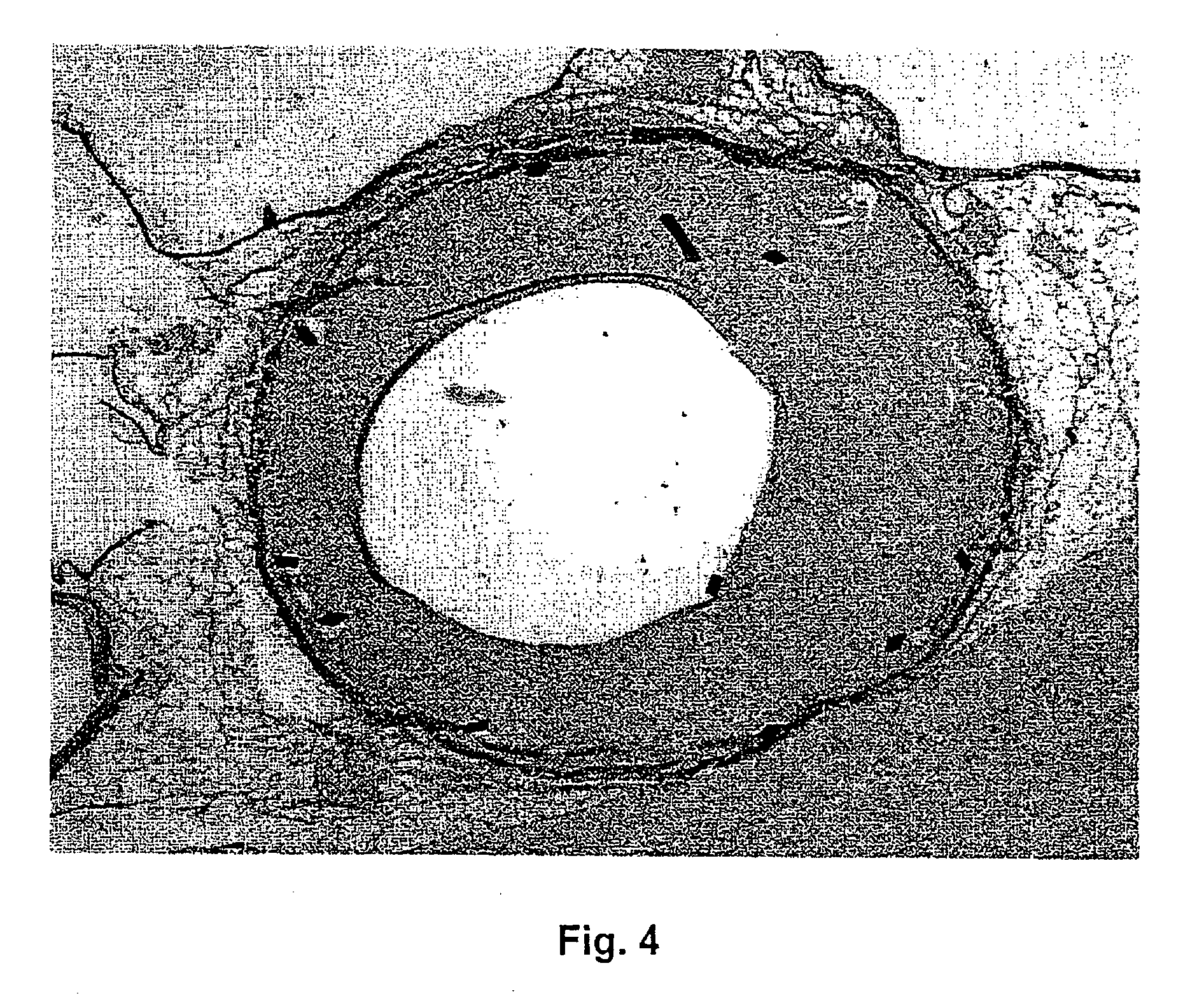 Use of one or more elements from the group containing yttrium, neodymium and zirconium and pharmaceutical compositions containing said elements