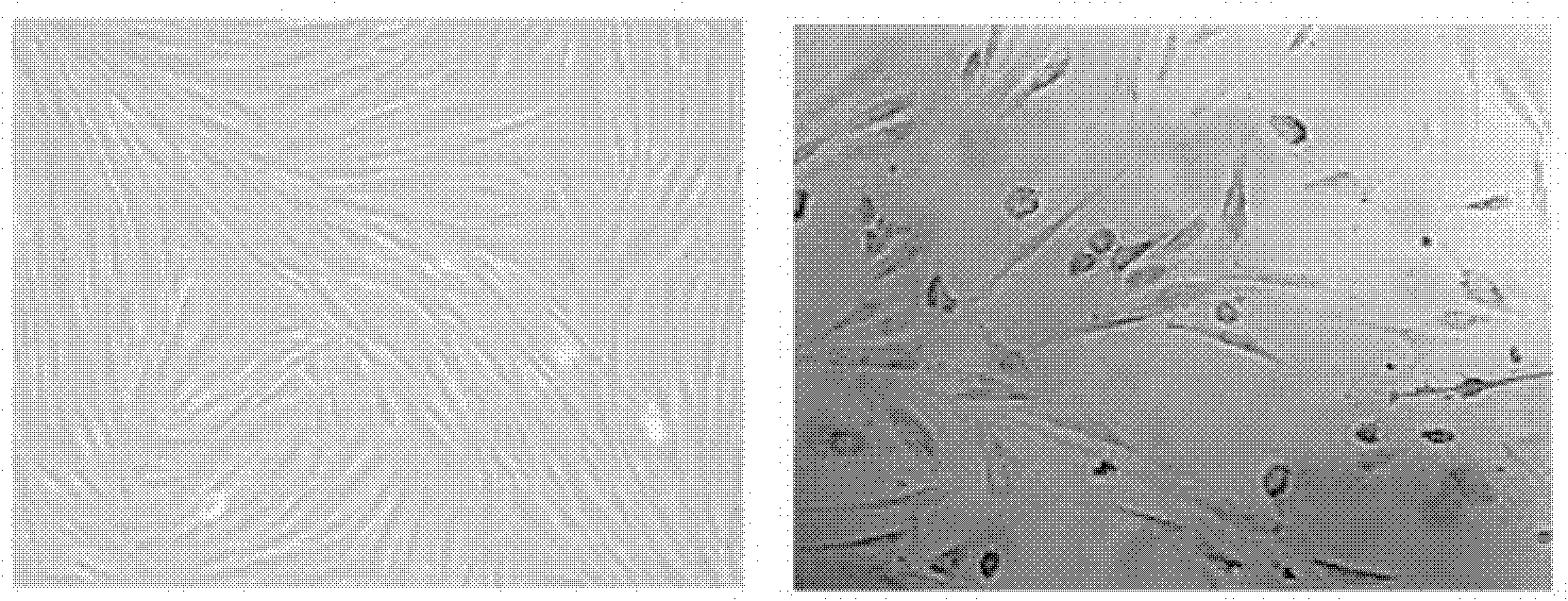 Method for directionally inducing insulin-secreting cells by endometrial stem cells