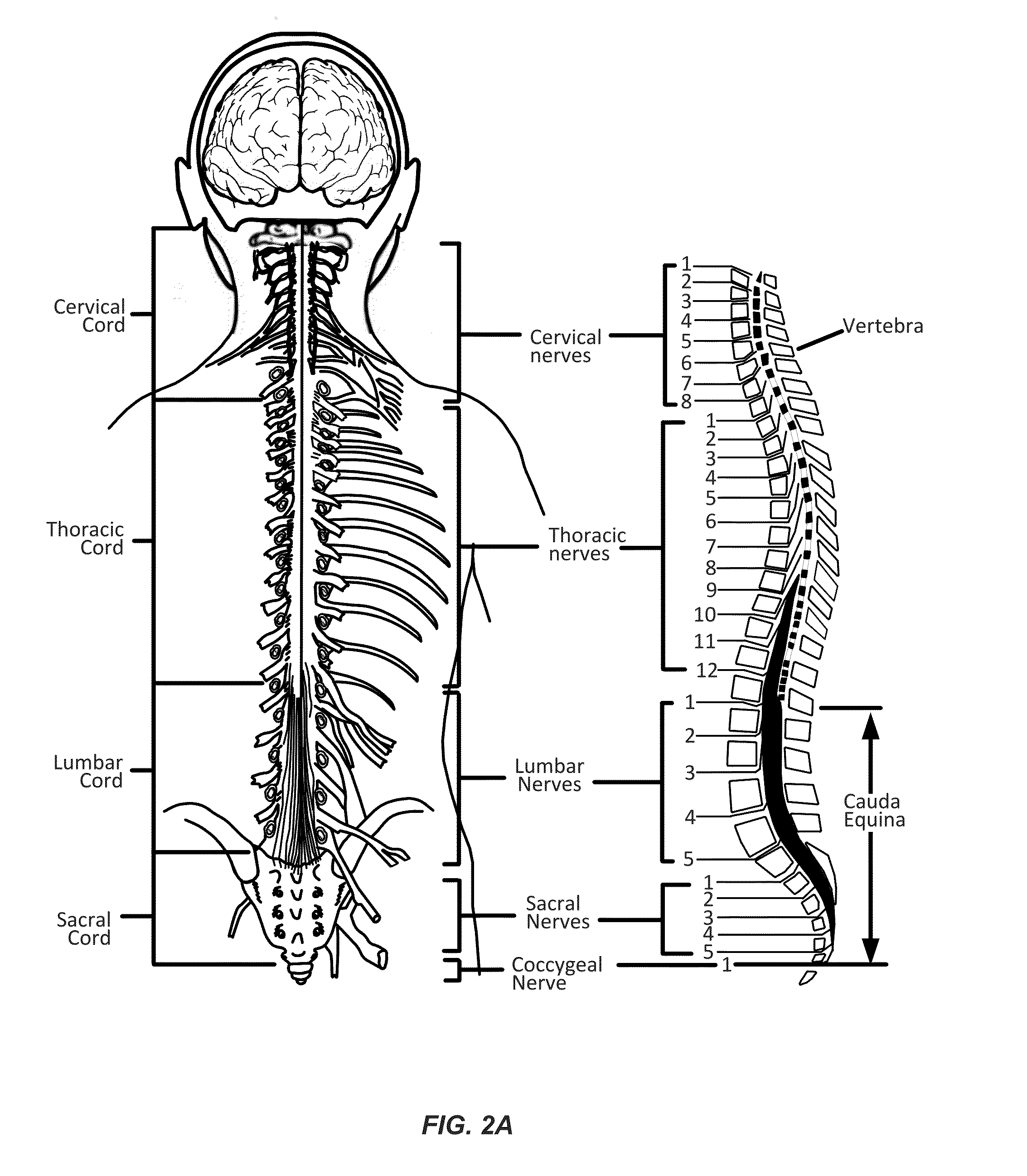 Implantable Lead Affixation Structure for Nerve Stimulation to Alleviate Bladder Dysfunction and Other Indication