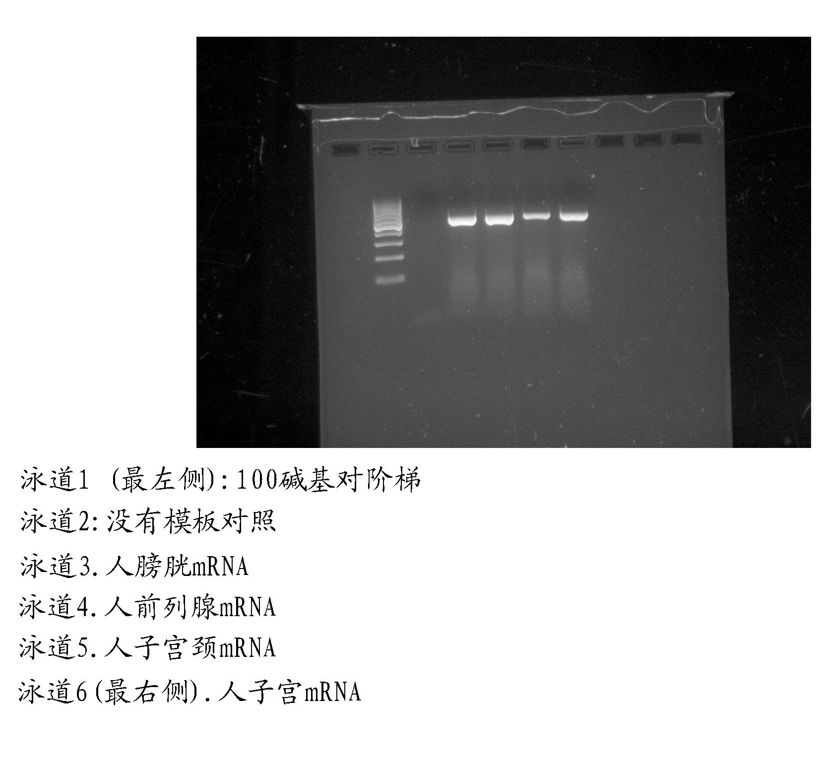 Therapeutic modulation of vaginal epithelium boundary lubrication