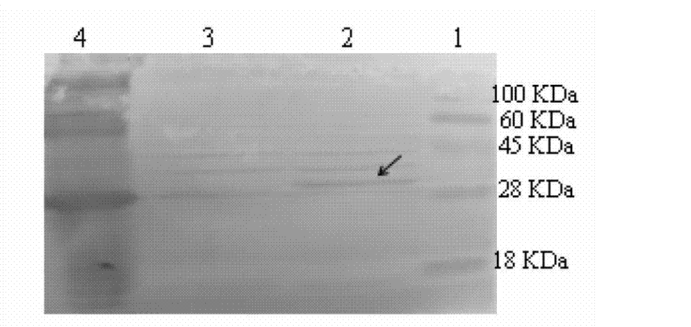 Method for expressing eimeria acevulina 3-1E protein in lactococcus lactis