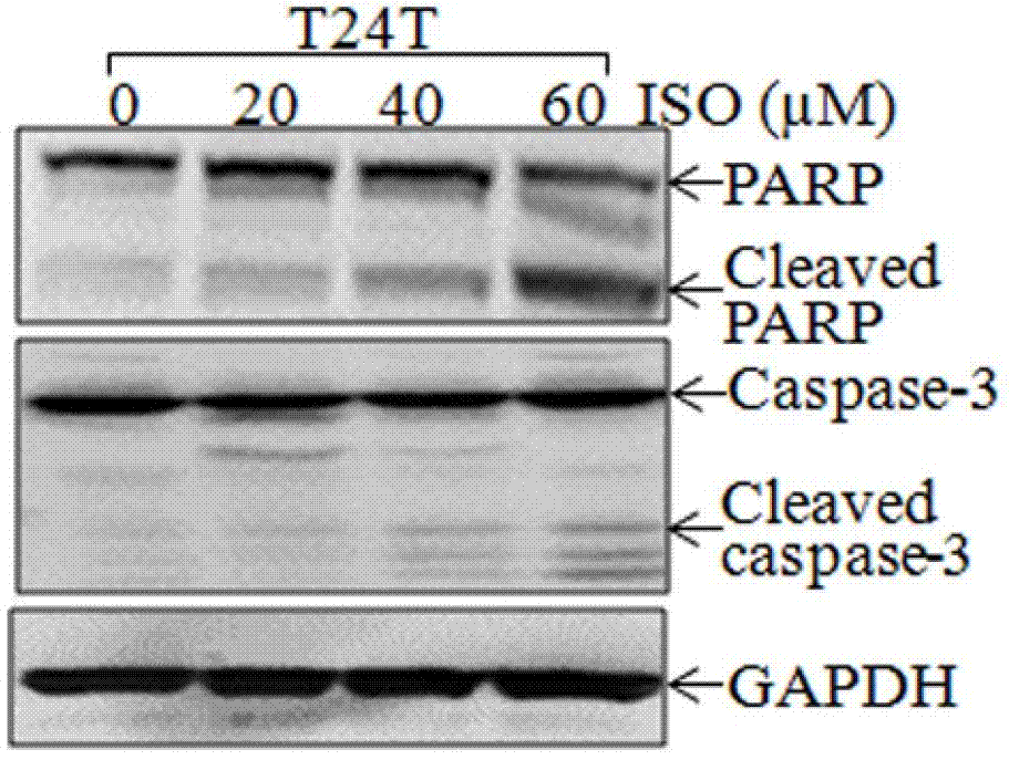 Application of isorhapontigenin (ISO) to preparation of drugs with antitumor activity