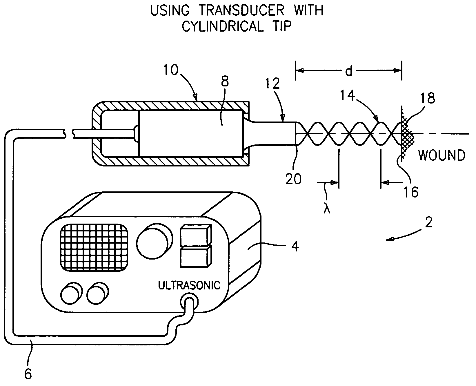 Ultrasound wound treatment method and device using standing waves