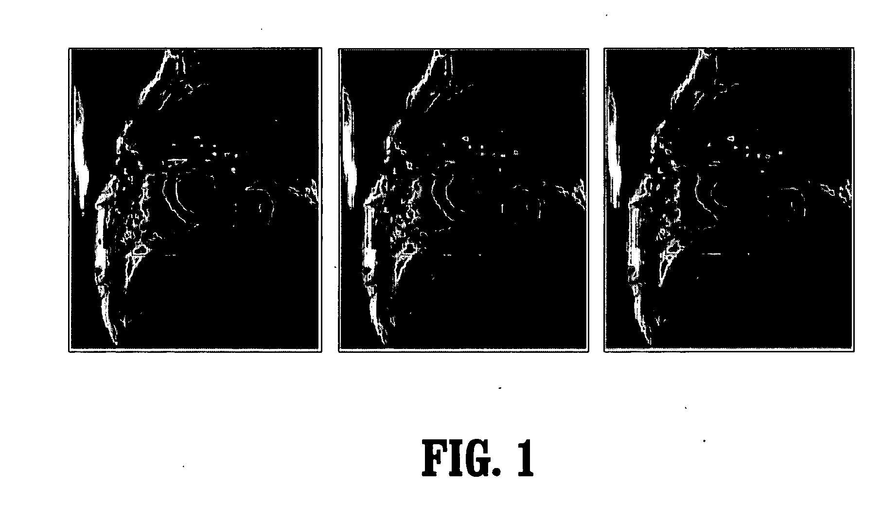 System and Method For Myocardium Segmentation In Realtime Cardiac MR Data