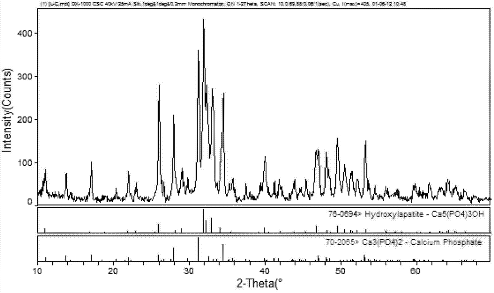 Preparation method and application of bioactive factor loaded temperature-sensitive composite gel carrier