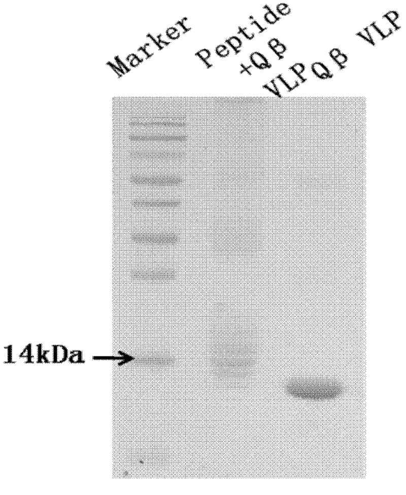 Vascular smooth muscle L type calcium ion channel immunogenic peptide and application thereof