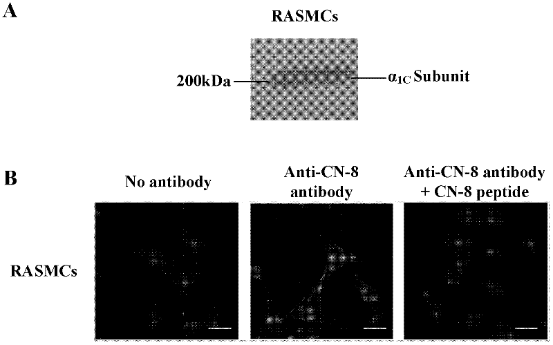 Vascular smooth muscle L type calcium ion channel immunogenic peptide and application thereof