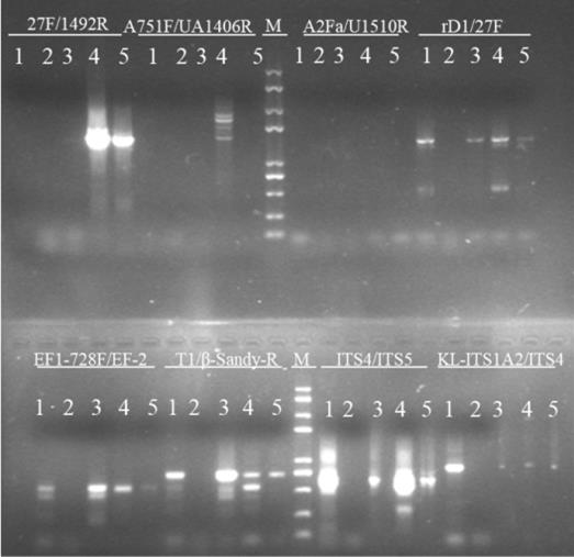 Primers for identifying pathogenic microorgansims of apple tree branch and trunk rot and disease degree grading method