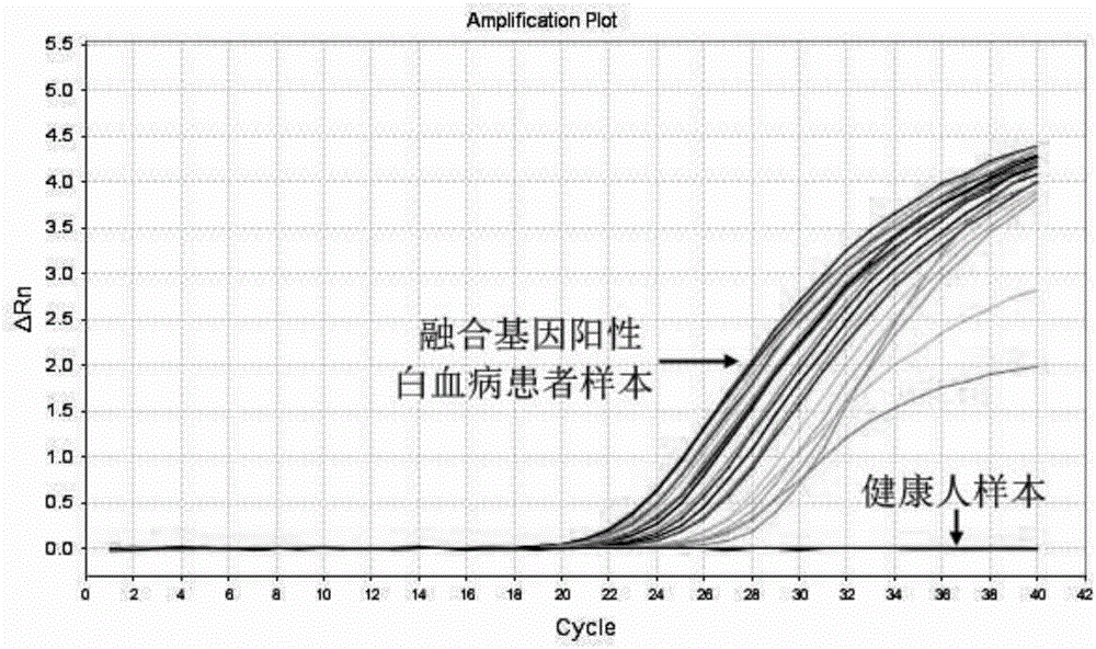 Multiplex fluorescent PCR kit and method for detecting fusion genes of leukemia