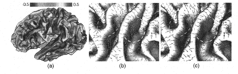 Brain cortex surface maximum principal direction field diffusion method for three-dimensional brain magnetic resonance image