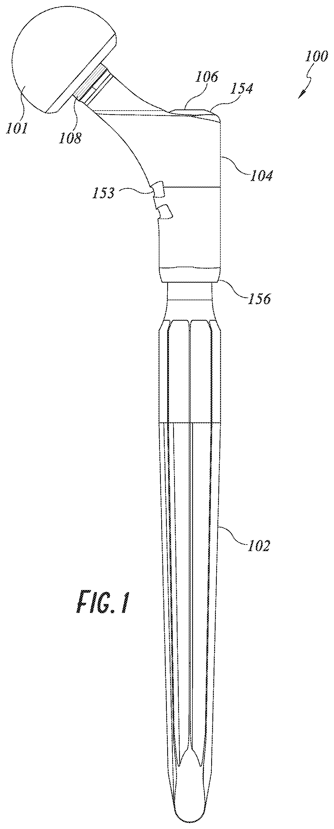 Hip implant system