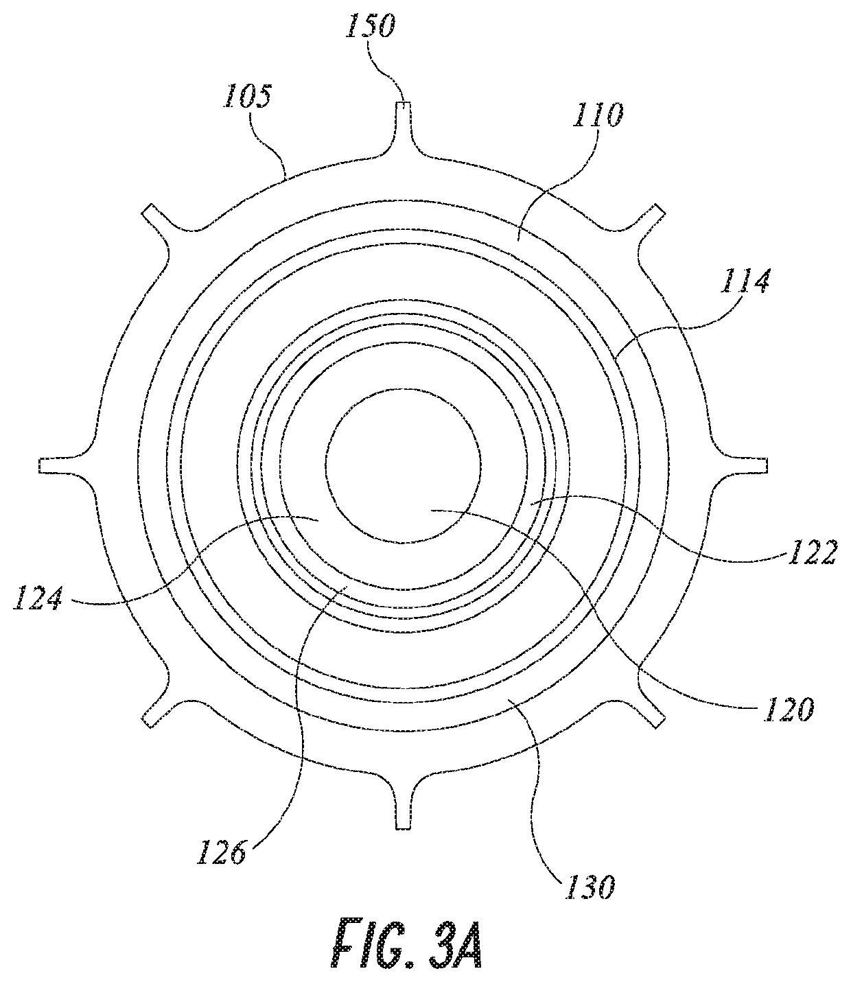 Hip implant system