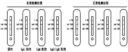 Preparation method of novel coronavirus 2019-nCoV IgM/IgG antibody combined detection kit