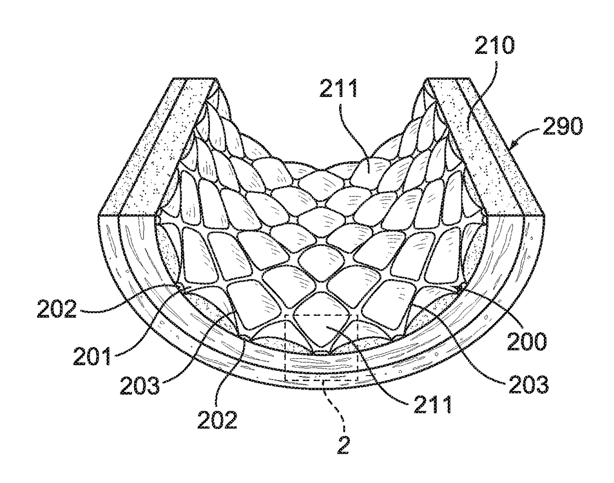 Grooved drug-eluting medical devices and method of making same