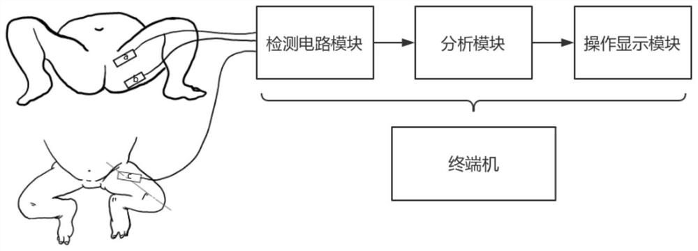 An auxiliary hip joint orthopedic system and orthopedic method