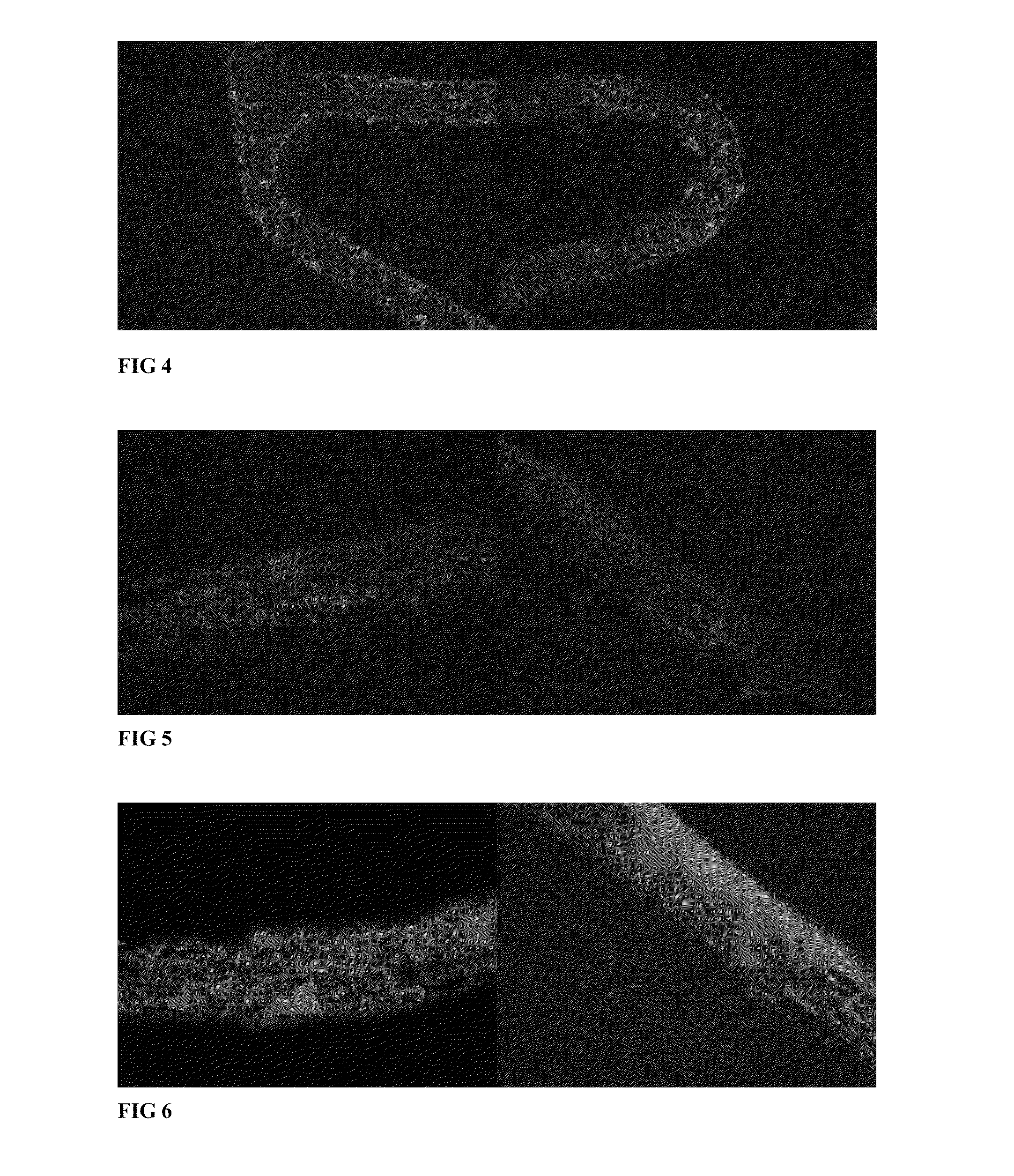 Blood vessel stent of amidoglucosan polysaccharide loaded with CD133 antibody and its preparation method