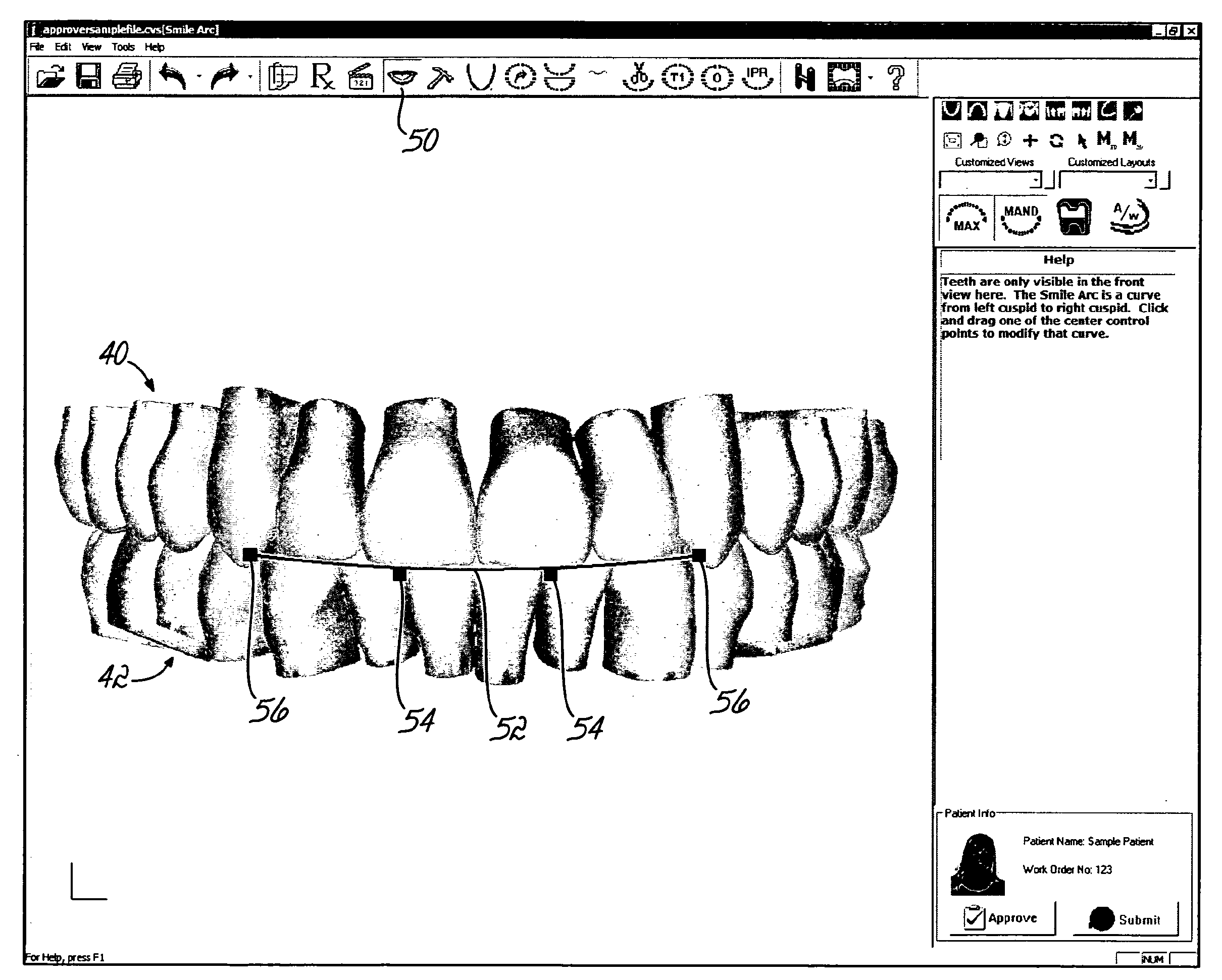 Software and Methods for Dental Treatment Planning