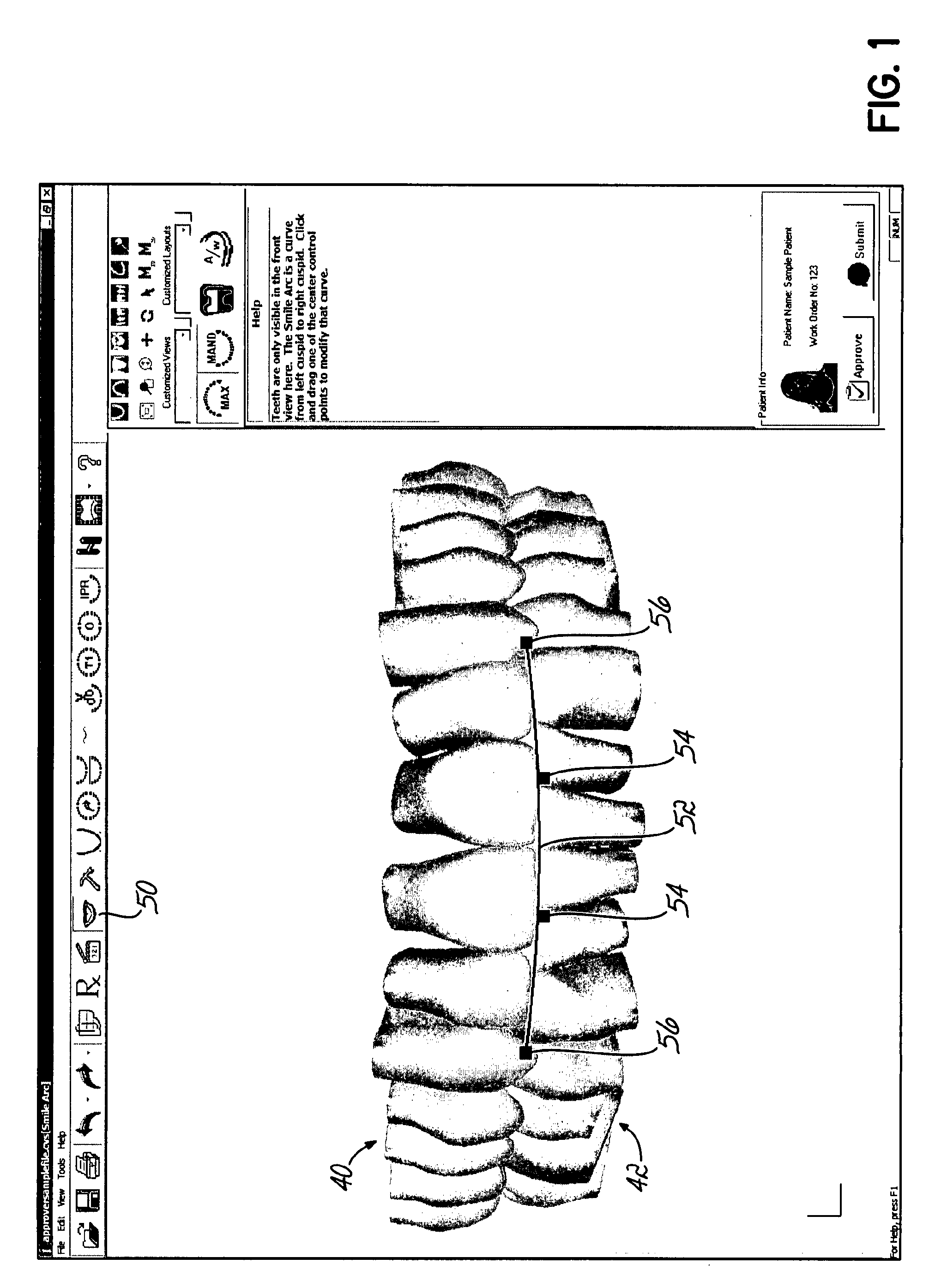 Software and Methods for Dental Treatment Planning