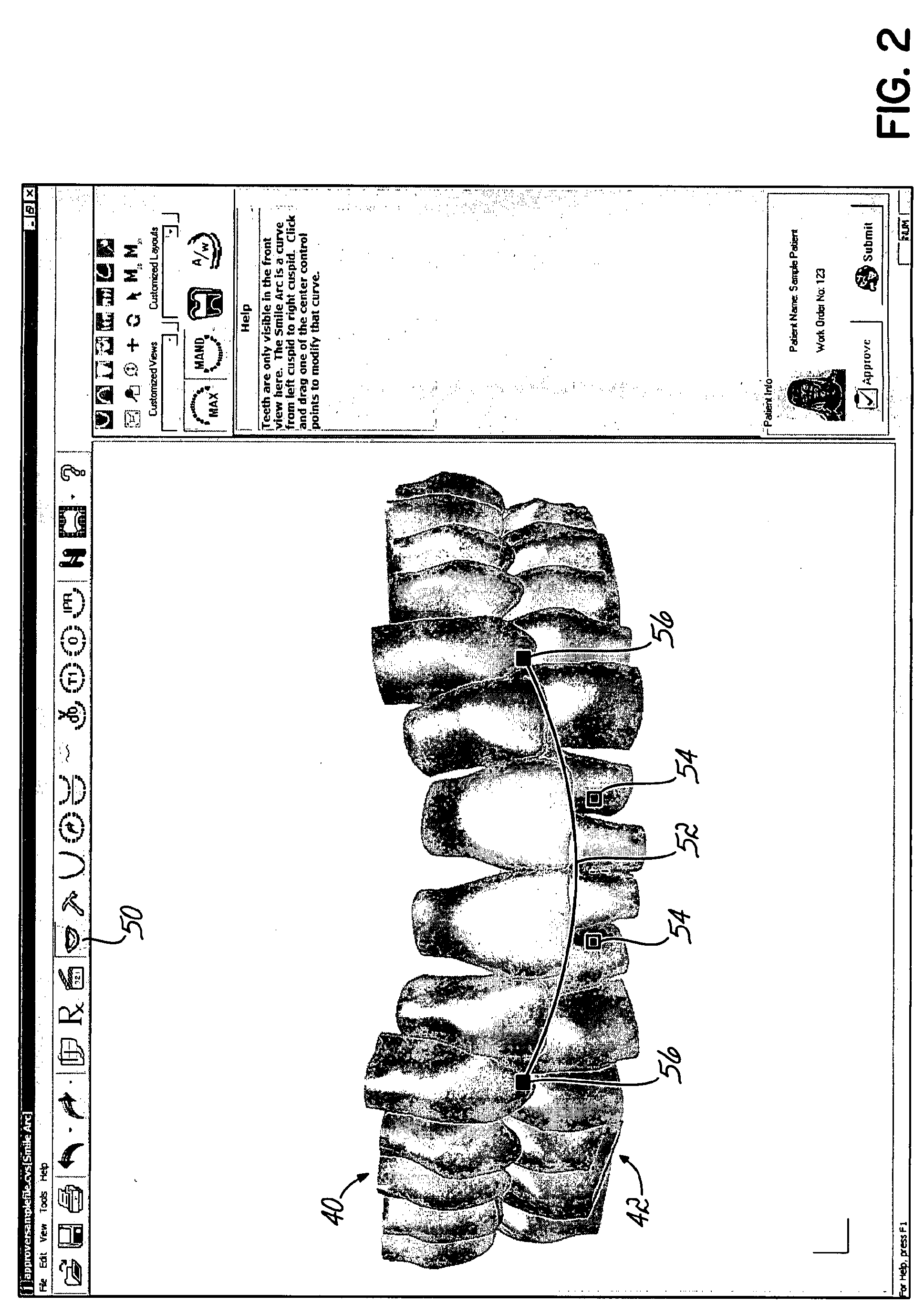 Software and Methods for Dental Treatment Planning