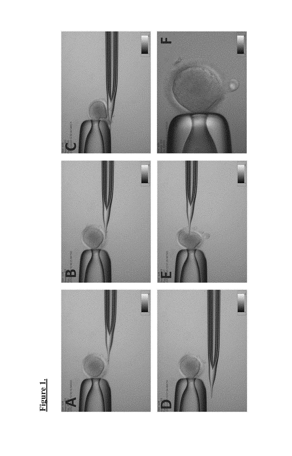 Production of parthenogenetic stem cells and patient-specific human embryonic stem cells using somatic cell nuclear transfer