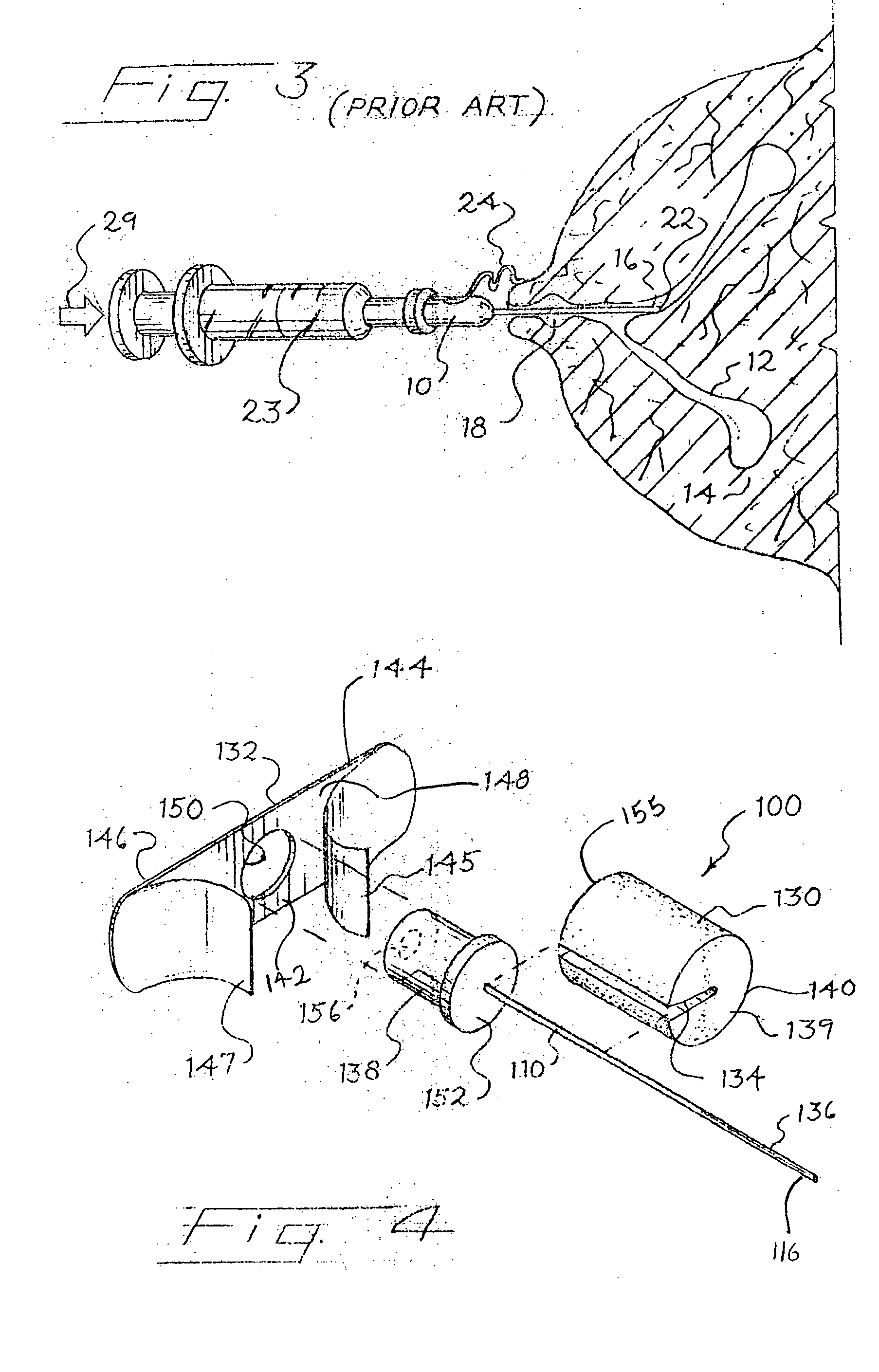 Catheter retainer