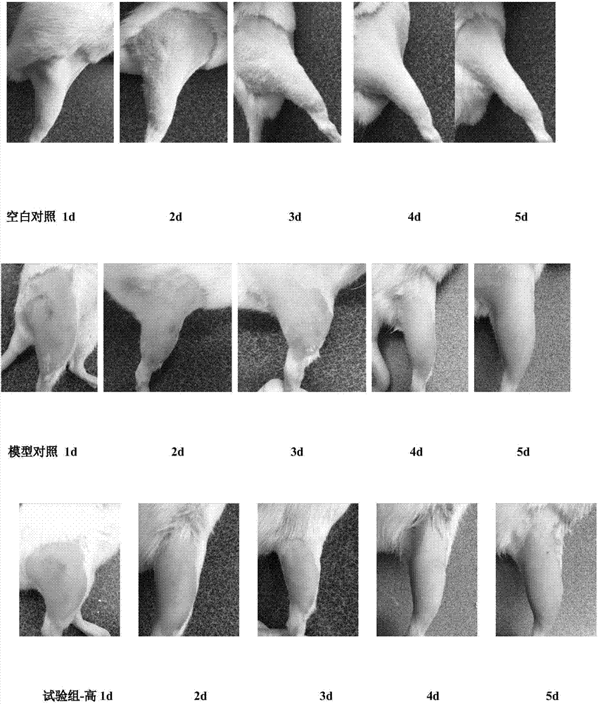 Pharmaceutical composition for treating acute soft-tissue injury