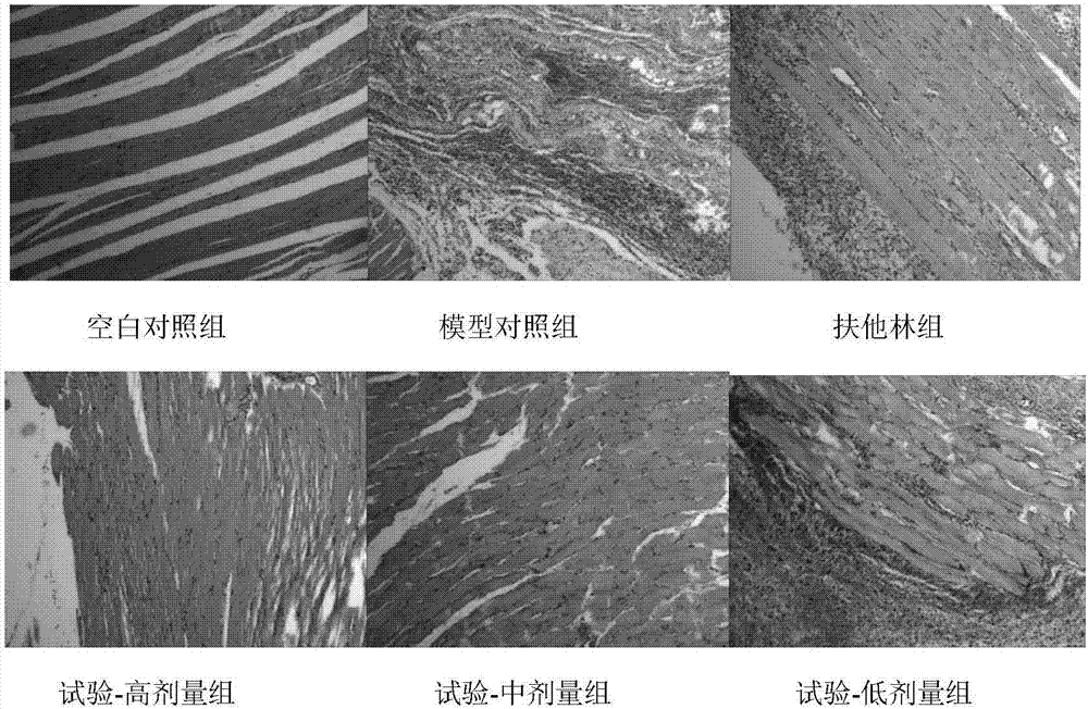 Pharmaceutical composition for treating acute soft-tissue injury