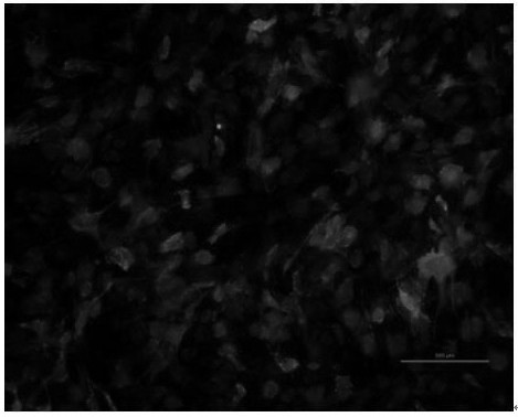 A method for inducing chondrogenic differentiation of stem cells