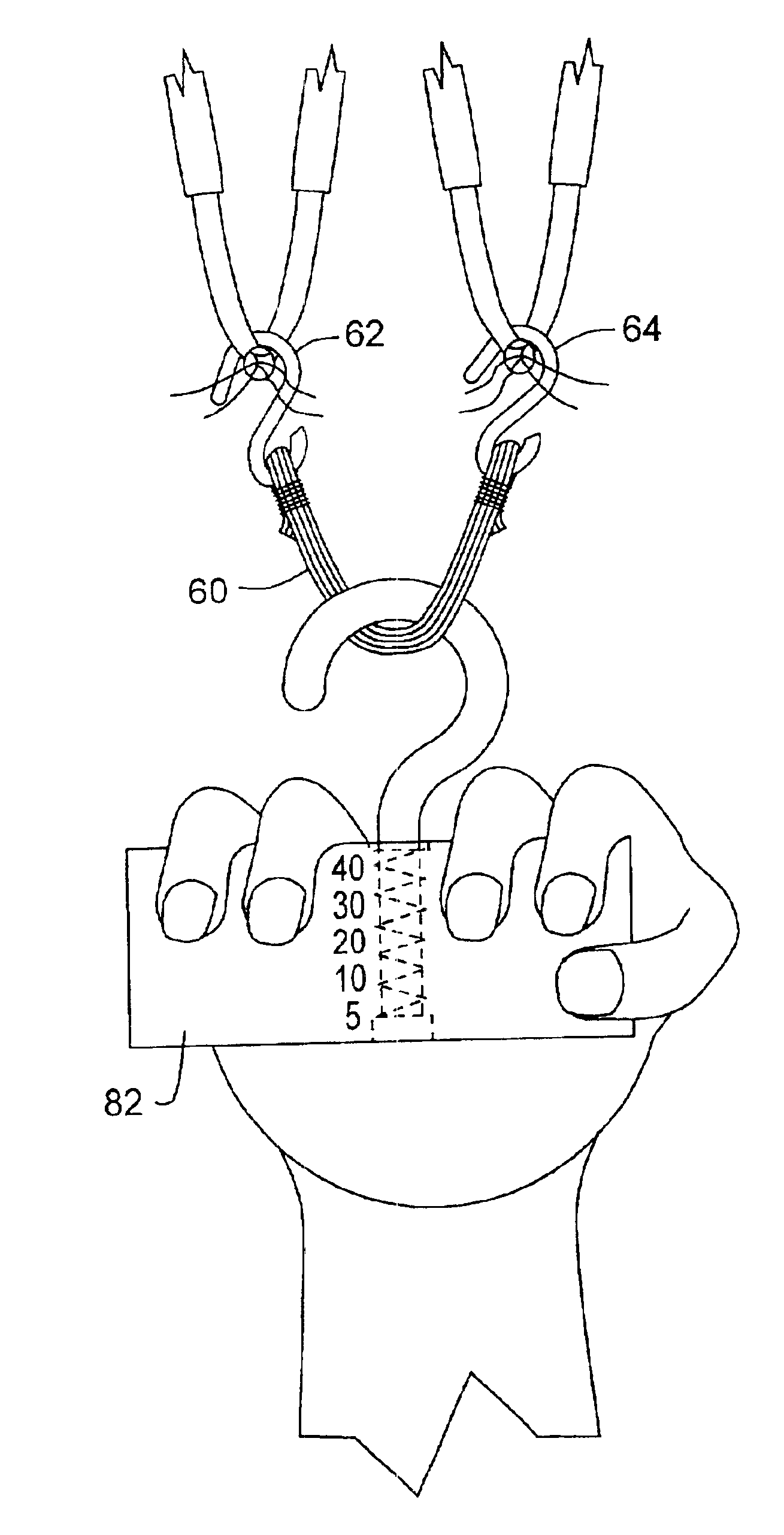 Ligament reconstruction tensioning device