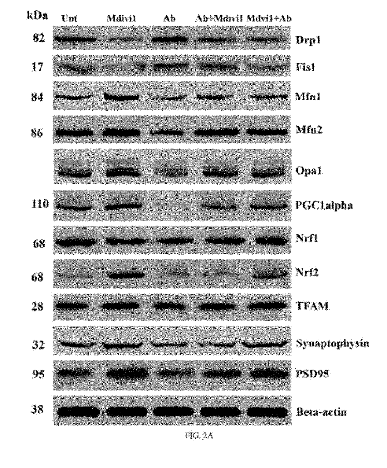 Mitochondria-Division Inhibitor 1 Protects Against Amyloid-B Induced Mitochondrial Fragmentation and Synaptic Damage in Alzheimer's Disease