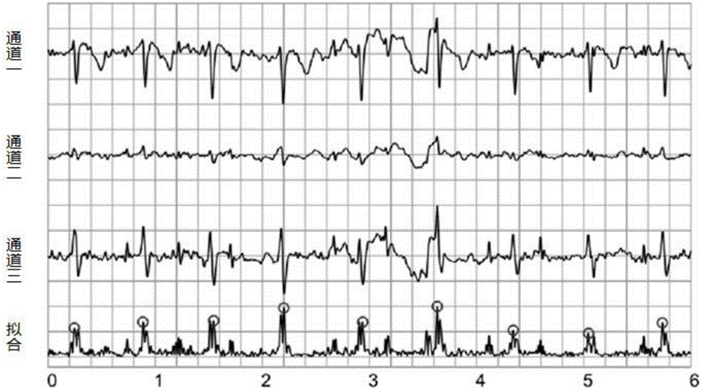 Intelligent terminal for achieving multi-channel electrocardiogram QRS automatic planning