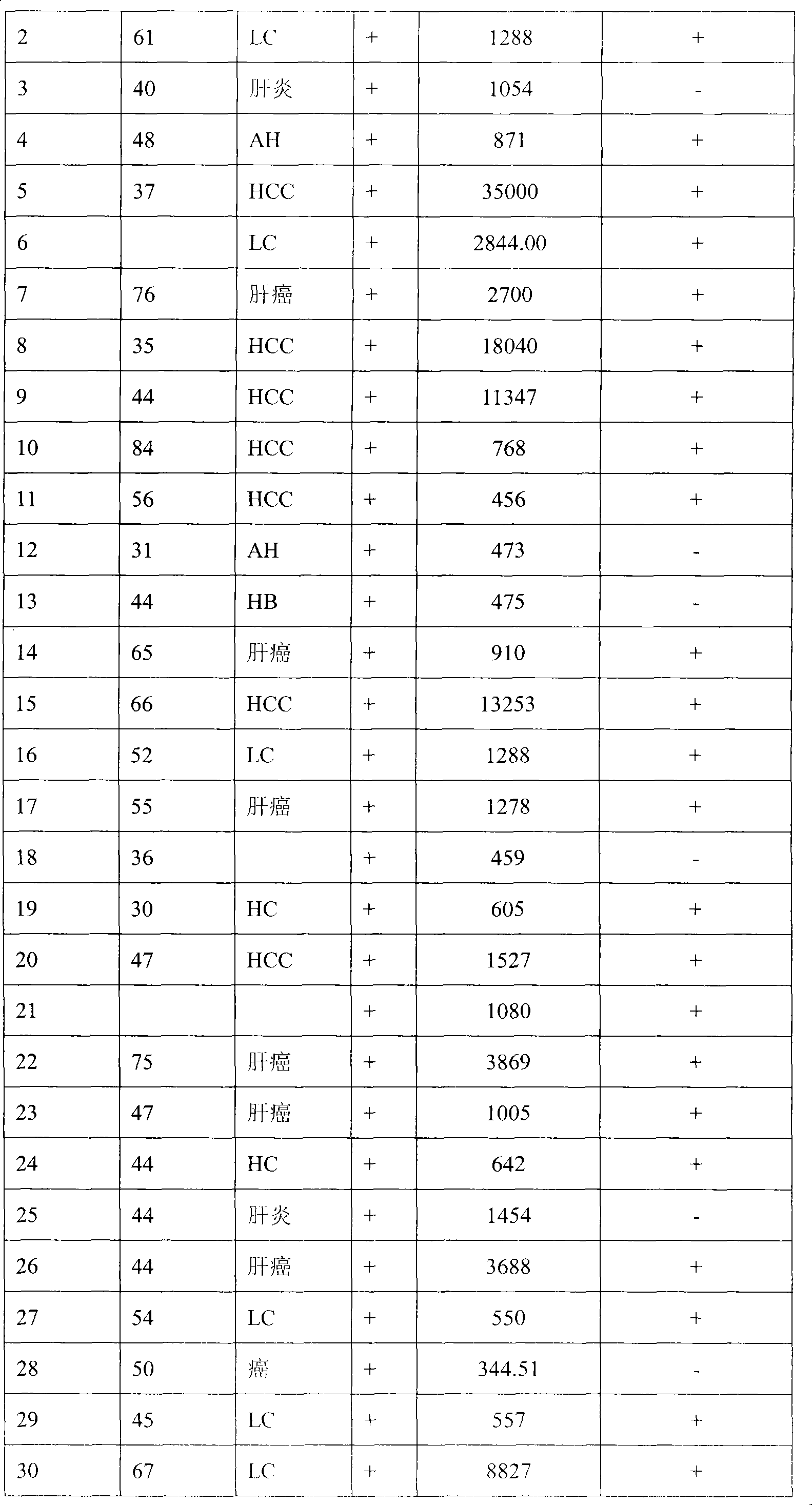 Reagent plate for rapidly detecting hepatocarcinoma, making method thereof and applications