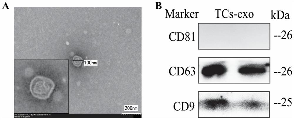 Exosome of mouse lung telocyte line as well as extraction method and application of exosome