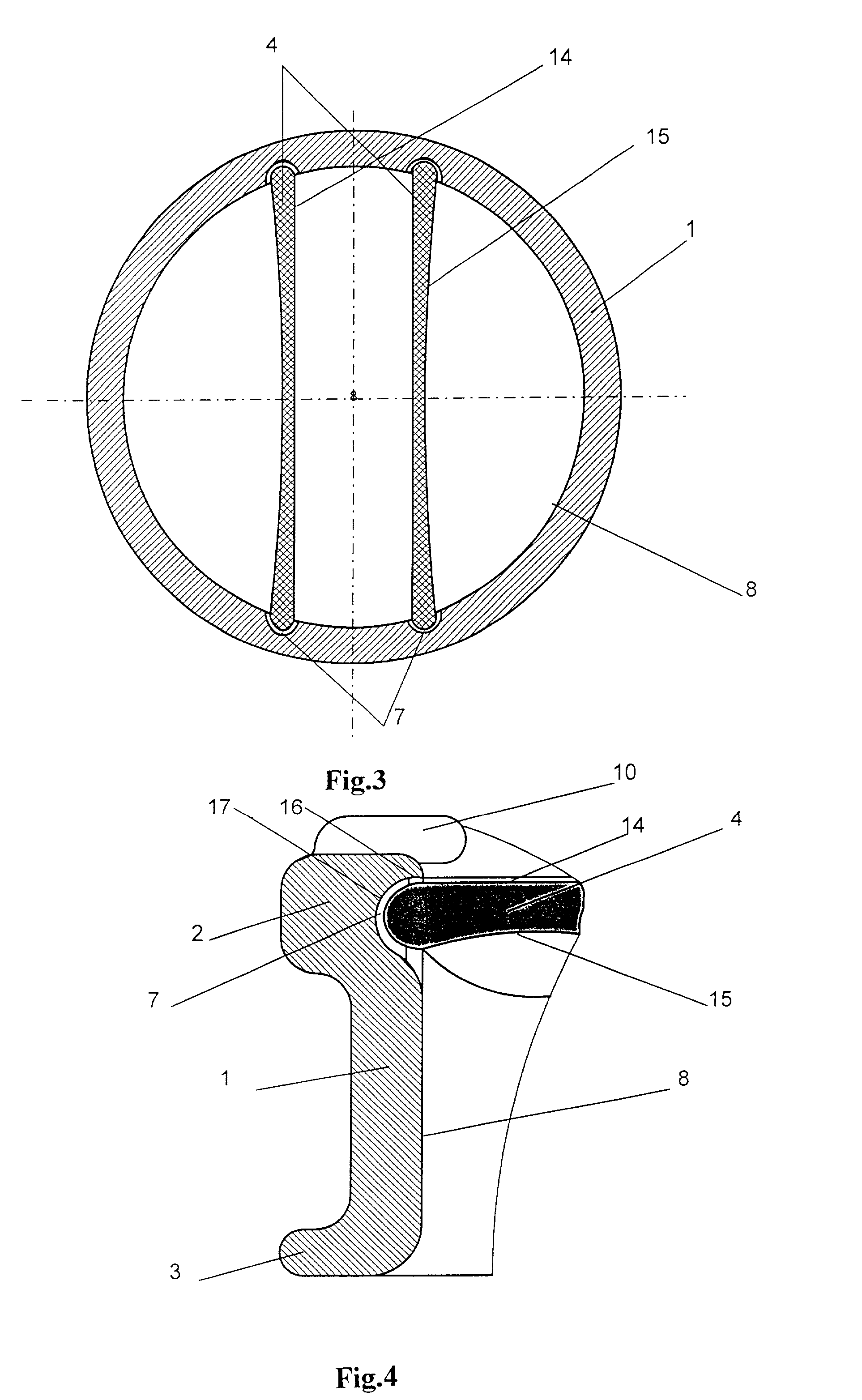 Heart valve prosthesis