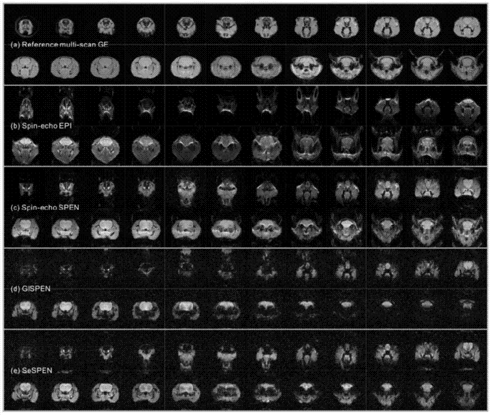 A multi-layer ultrafast magnetic resonance imaging method based on segmented excitation spatiotemporal encoding